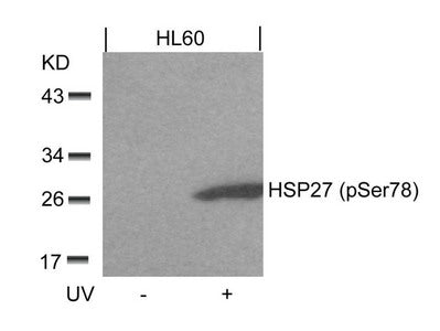 Phospho-HSPB1 (Ser78) Antibody