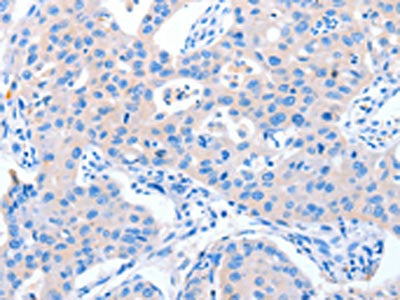 NUAK1 Antibody
