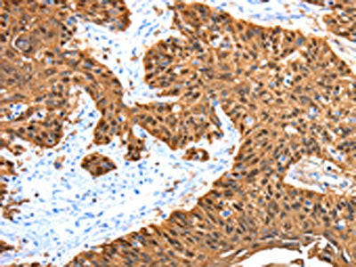 ADAMTS5 Antibody