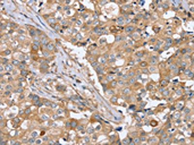 PPP2R3A Antibody