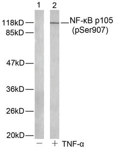 Phospho-NFKB1 (Ser907) Antibody