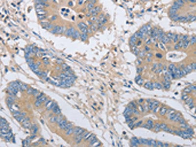 OASL Antibody