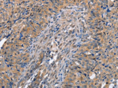 MAP2K1 Antibody