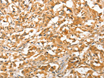 APTX Antibody