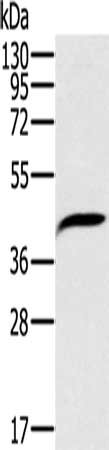 PDSS2 Antibody