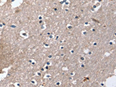 DUT Antibody