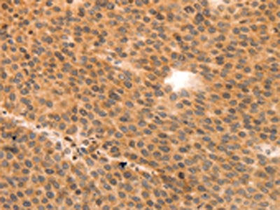 MYL9 Antibody