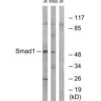 SMAD1 (Ab-187) Antibody
