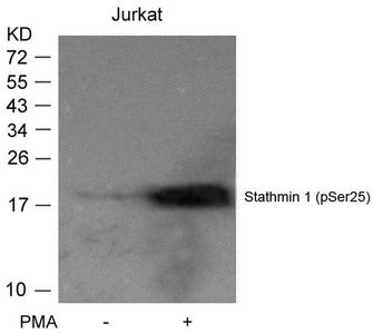 Phospho-STMN1 (Ser25) Antibody
