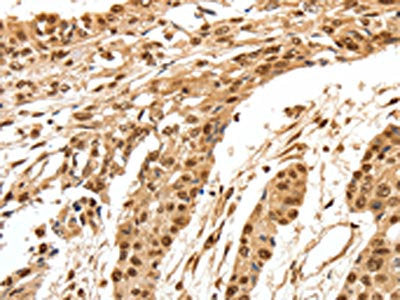 SPATA20 Antibody
