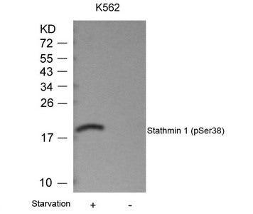 Phospho-STMN1 (Ser38) Antibody
