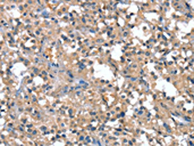 CAPZA1 Antibody