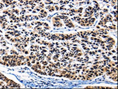 AP1B1 Antibody