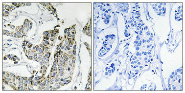 Phospho-BLK (Tyr501) Antibody