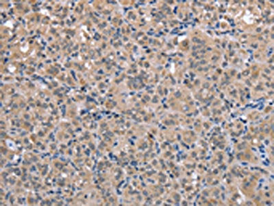 FOXO1 Antibody