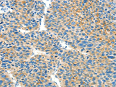 BCAT1 Antibody