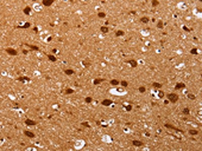 PSMD3 Antibody