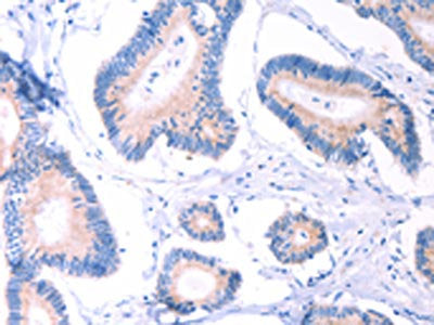 AADAC Antibody