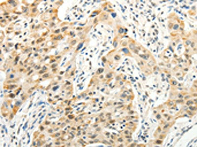 VANGL2 Antibody