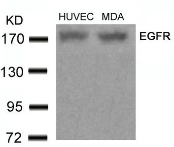 EGFR (Ab-678) Antibody