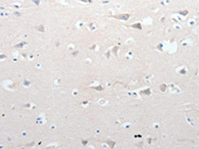 GCH1 Antibody