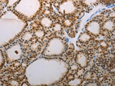 S100A1 Antibody