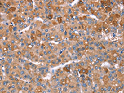 GPC6 Antibody