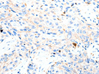 P2RY1 Antibody
