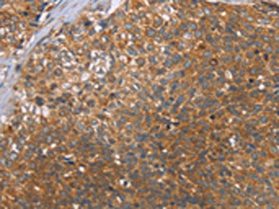 CCL21 Antibody