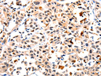 IL23R Antibody
