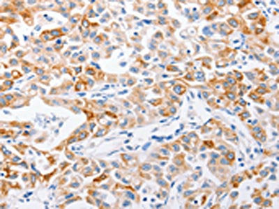 MMP10 Antibody