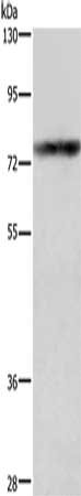 GALC Antibody