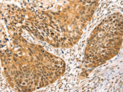 RRAGC Antibody
