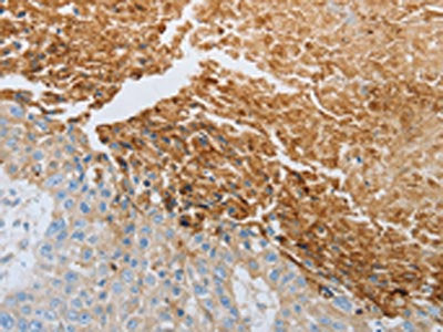 RTN4 Antibody