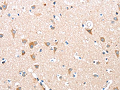 ADAM15 Antibody