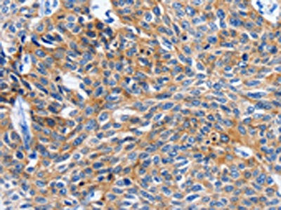ITGAL Antibody