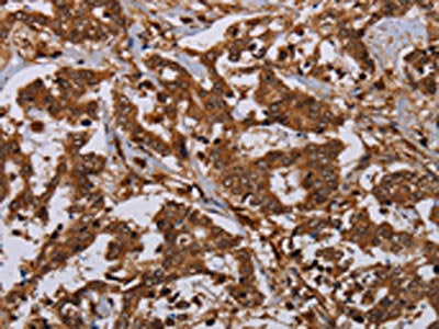 MOB1A Antibody