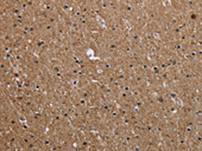 CMTM5 Antibody