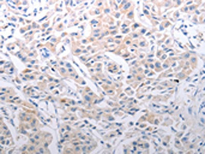 SLC39A6 Antibody