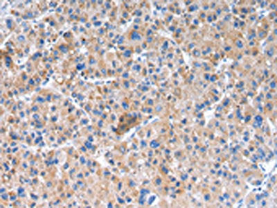 GLRA1 Antibody
