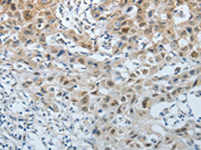 CDKN1A Antibody