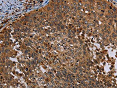 OSM Antibody
