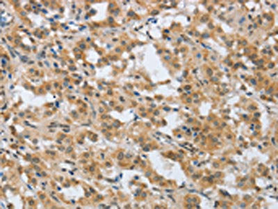 GPER1 Antibody
