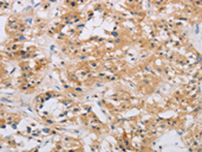 RAD54L2 Antibody