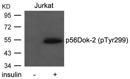 Phospho-DOK2 (Tyr299) Antibody