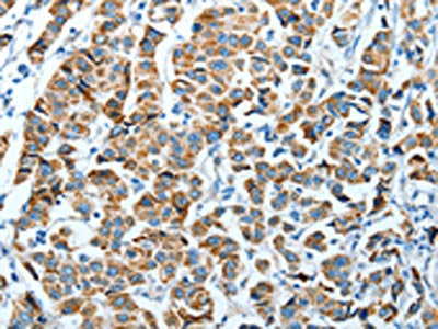 ALDH4A1 Antibody
