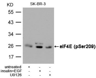 Phospho-EIF4E (Ser209) Antibody