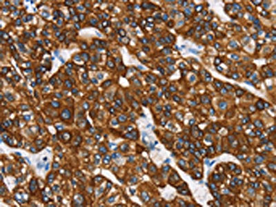 KRT8 Antibody