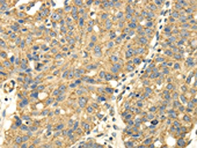 UHRF1BP1 Antibody