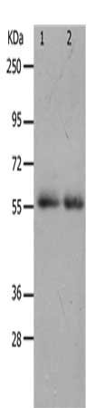 MMP17 Antibody